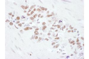 Immunohistochemistry (IHC) image for anti-MRE11 Meiotic Recombination 11 Homolog A (S. Cerevisiae) (MRE11A) (AA 658-708) antibody (ABIN7454999) (Mre11 antibody  (AA 658-708))