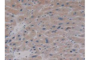 IHC-P analysis of Human Liver Tissue, with DAB staining. (AKT2 antibody  (AA 142-412))