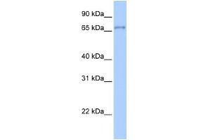 WB Suggested Anti-ZNF76 Antibody Titration:  0.
