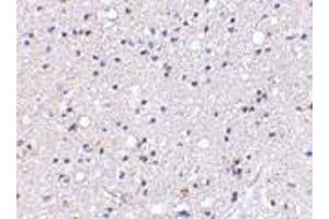 Immunohistochemical staining of human brain tissue using AP30384PU-N Grik4 antibody at 2. (GRIK4 antibody  (C-Term))