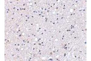 Immunohistochemical staining of human brain tissue using AP30384PU-N Grik4 antibody at 2.