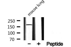 Western blot analysis on mouse lung lysate using RON Antibody. (MST1R antibody  (C-Term))