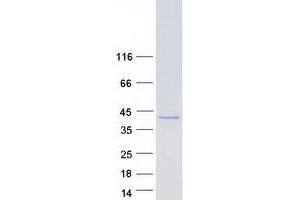 Validation with Western Blot