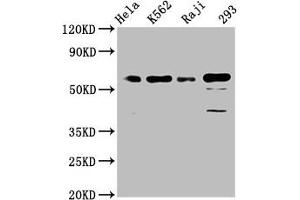 Western Blot Positive WB detected in: Hela whole cell lysate, K562 whole cell lysate, Raji whole cell lysate, 293 whole cell lysate All lanes: Cdc25C antibody at 1. (Recombinant CDC25C antibody)
