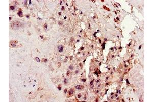 Immunohistochemistry of paraffin-embedded human placenta tissue using ABIN7162131 at dilution of 1:100 (Uncharacterized Protein C4orf26 (ODAPH) (AA 24-130) antibody)