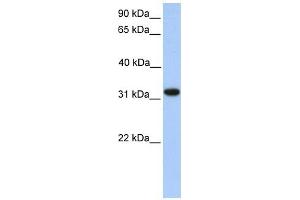 ETFA antibody used at 1 ug/ml to detect target protein. (ETFA antibody)