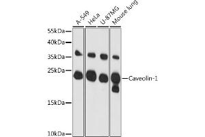 Western blot analysis of extracts of various cell lines, using Caveolin-1 antibody (ABIN6131271, ABIN6137992, ABIN6137993 and ABIN6218615) at 1:3000 dilution. (Caveolin-1 antibody  (AA 1-100))