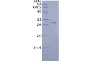 SDS-PAGE of Protein Standard from the Kit (Highly purified E. (Complement Factor H ELISA Kit)