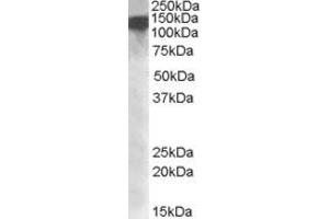 EB09297 (1µg/ml) staining of nuclear HeLa lysate (35µg protein in RIPA buffer). (DHX9 antibody  (Internal Region))