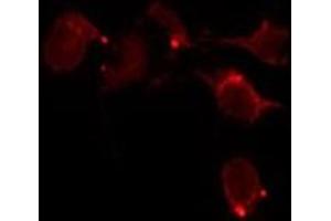 ABIN6277843 staining HepG2 by IF/ICC. (BCL2A1 antibody  (Internal Region))