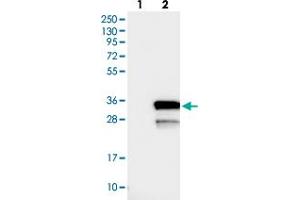 Western blot analysis of Lane 1: Negative control (vector only transfected HEK293T lysate), Lane 2: Over-expression Lysate (Co-expressed with a C-terminal myc-DDK tag (~3. (LYSMD1 antibody)