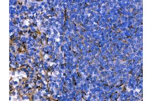 IHC analysis of Hsp47/SERPINH1 using anti-Hsp47/SERPINH1 antibody (ABIN3043331). (SERPINH1 antibody  (AA 247-418))