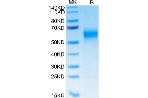 Human IL-1R3 on Tris-Bis PAGE under reduced condition. (IL1RAP Protein (AA 21-359) (His-Avi Tag))