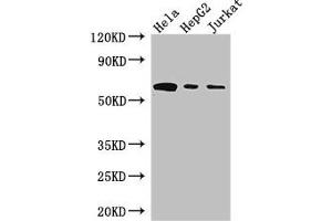 Western Blot Positive WB detected in: Hela whole cell lysate, HepG2 whole cell lysate, Jurkat whole cell lysate All lanes: HPSE antibody at 3 μg/mL Secondary Goat polyclonal to rabbit IgG at 1/50000 dilution Predicted band size: 62, 55, 54, 43 kDa Observed band size: 62 kDa (HPSE antibody  (AA 263-523))