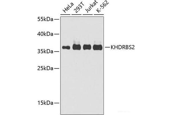 KHDRBS2 anticorps