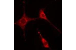 ABIN6269331 staining  HeLa cells by IF/ICC. (Caldesmon antibody  (C-Term))