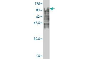 Western Blot detection against Immunogen (96. (ECD/SGT1 antibody  (AA 1-644))