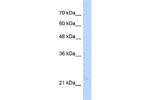 WB Suggested Anti-NUDT16L1 Antibody Titration: 5. (NUDT16L1 antibody  (C-Term))