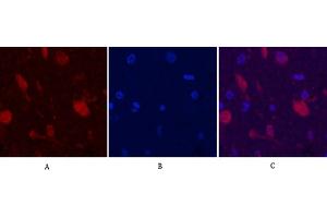 Immunofluorescence analysis of rat brain tissue. (Ubiquitin antibody)
