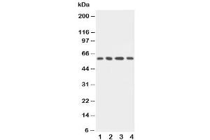 Western blot testing of uPAR antibody and Lane 1:  MCF-7 (uPAR uPA Receptor (C-Term) antibody)