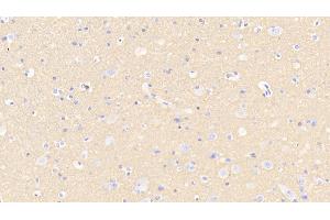 Detection of SNAP25 in Human Cerebellum Tissue using Polyclonal Antibody to Synaptosomal Associated Protein 25 kDa (SNAP25)