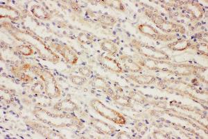 Immunohistochemistry (IHC) image for anti-Protein Phosphatase 2, Catalytic Subunit, alpha Isozyme (PPP2CA) (AA 6-20), (N-Term) antibody (ABIN3044492)