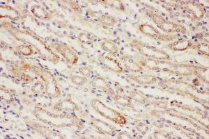 Anti-PP2A antibody, IHC(P) IHC(P): Rat Kidney Tissue