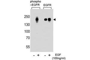 Western blot analysis of lysate from A431 cells (left to right), untreated or treated with EGF at 100ng/ml, using phospho-EGFR antibody (pS768) or nonphos Ab at 1:1000 dilution.