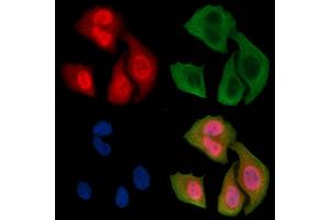 ABIN6256440 and ABIN6267350 staining Hela cells(30 min of UV treatment) by IF/ICC.
