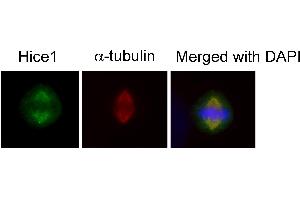Immunofluorescence analysis of human osteosarcoma cell line U2OS, using HICE1 antibody at 1:50-1:200 dilution. (NYS48/HAUS8 antibody)