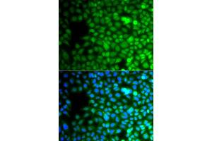 Immunofluorescence analysis of A549 cell using ZNF195 antibody. (ZNF195 antibody)