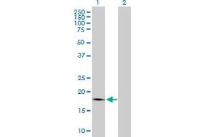 Western Blotting (WB) image for anti-Protein Tyrosine Phosphatase Type IVA, Member 1 (PTP4A1) (AA 1-173) antibody (ABIN521641)