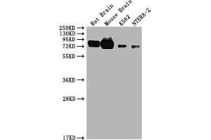 Western Blot Positive WB detected in: Rat brain tissue, Mouse brain tissue, K562, NTERA-2 All lanes: WASF1 antibody at 1. (WASF1 antibody  (AA 381-553))