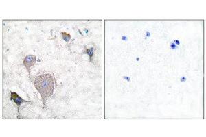 Immunohistochemistry (IHC) image for anti-Peripherin (PRPH) (C-Term) antibody (ABIN1848740)