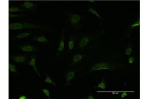 Immunofluorescence of monoclonal antibody to BCL9 on HeLa cell. (BCL9 antibody  (AA 1036-1135))