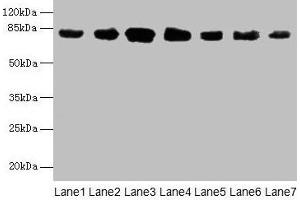 Western blot All lanes: CLGN antibody at 7 μg/mL Lane 1: Mouse brain tissue Lane 2: Mouse lung tissue Lane 3: Jurkat whole cell lysate Lane 4: HepG2 whole cell lysate Lane 5: PC-3 whole cell lysate Lane 6: Hela whole cell lysate Lane 7: HL60 whole cell lysate Secondary Goat polyclonal to rabbit IgG at 1/10000 dilution Predicted band size: 71, 47 kDa Observed band size: 80 kDa