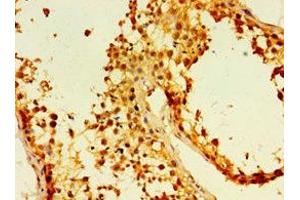 Immunohistochemistry of paraffin-embedded human testis tissue using ABIN7173881 at dilution of 1:100 (Ectodysplasin A2 Receptor antibody  (AA 1-138))