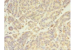 Immunohistochemistry (IHC) image for anti-FYN Oncogene Related To SRC, FGR, YES (FYN) (AA 154-270) antibody (ABIN7174025)