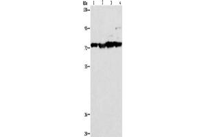 Western Blotting (WB) image for anti-Matrix Metallopeptidase 15 (Membrane-inserted) (MMP15) antibody (ABIN2421859) (MMP15 antibody)