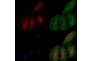 ABIN6257787 and ABIN6274815 staining  cells by IF/ICC. (BST1 antibody  (Internal Region))