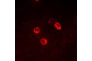 Immunofluorescent analysis of CG alpha staining in MCF7 cells. (CGA antibody)