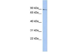 WB Suggested Anti-MLH1 Antibody Titration: 0. (MLH1 antibody  (N-Term))