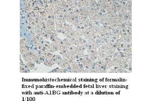 Image no. 1 for anti-alpha-1-B Glycoprotein (A1BG) antibody (ABIN791226) (A1BG antibody)
