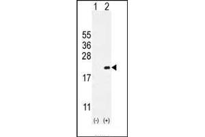 Western blot analysis of CDKN2C (arrow) using rabbit polyclonal CDKN2C Antibody (C-term) (ABIN654908 and ABIN2844555).