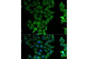 Immunofluorescence analysis of MCF7 cells using ELF3 Polyclonal Antibody (ELF3 antibody)