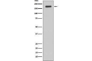 Western blot analysis of ErbB3 (HER3) expression in MCF-7 cell lysate.