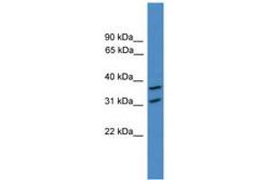 Image no. 1 for anti-OTU Domain Containing 6A (OTUD6A) (AA 51-100) antibody (ABIN6745381) (OTUD6A antibody  (AA 51-100))