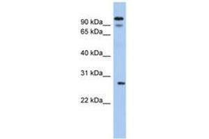 Image no. 1 for anti-Voltage-Dependent Anion Channel 3 (VDAC3) (AA 35-84) antibody (ABIN6742549) (VDAC3 antibody  (AA 35-84))