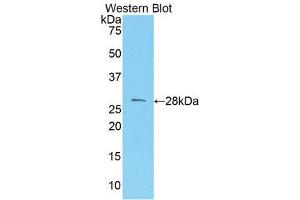 Western Blotting (WB) image for anti-Melanoma Cell Adhesion Molecule (MCAM) (AA 324-565) antibody (ABIN1859776) (MCAM antibody  (AA 324-565))