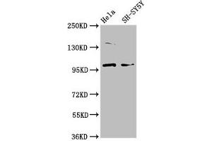 Western Blot Positive WB detected in: Hela whole cell lysate, SH-SY5Y whole cell lysate All lanes: PDE6C antibody at 3. (PDE6C antibody  (AA 285-451))